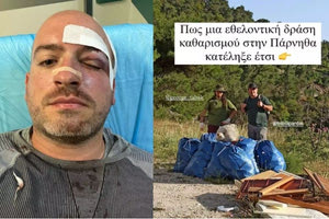 Εφιαλτικές στιγμές στην Πάρνηθα: Ξυλοκόπησαν άγρια και μαχαίρωσαν εθελοντές που μάζευαν σκουπίδια