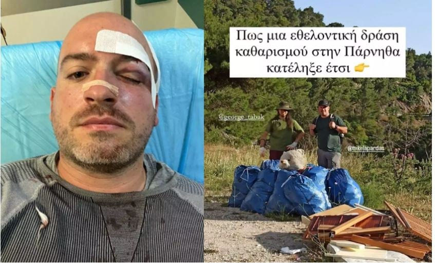 Εφιαλτικές στιγμές στην Πάρνηθα: Ξυλοκόπησαν άγρια και μαχαίρωσαν εθελοντές που μάζευαν σκουπίδια