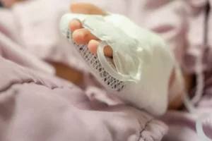 Σε κρίσιμη κατάσταση το 2χρονο κοριτσάκι που πήραν φωτιά τα ρούχα του