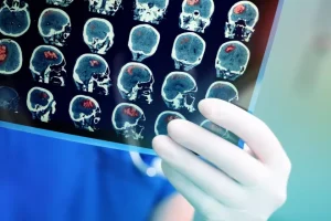 Αγρότης από την Κρήτη επέζησε έπειτα από πυροβολισμό στο κεφάλι: Το ιατρικό «θαύμα» έγινε θέμα σε διάσημο περιοδικό της Αμερικής