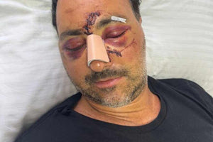 Ξυλοδαρμός Ελληνοκαναδού σε μπαρ του Ηρακλείου: Οργή των Αστυνομικών για τις δηλώσεις – καταγγελία του δικηγόρου του θύματος