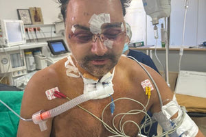 Εκδόθηκαν τα εντάλματα σύλληψης για τον άγριο ξυλοδαρμό του 49χρονου