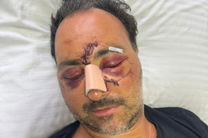 Ξυλοδαρμός 49χρονου Ελληνοκαναδού σε μπαρ του Ηρακλείου: Φωτογραφίες σοκ μέσα από το Βενιζέλειο