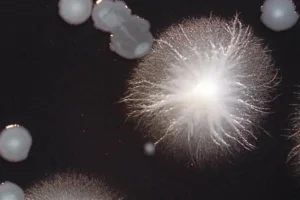 Συναγερμός στην Αυστραλία από τη «νόσο των Λεγεωνάριων»: Μία νεκρή και πολλά κρούσματα – Πώς μεταδίδεται