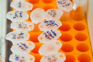 ΠΟΥ: Προειδοποίηση σχετικά με την έξαρση του ιού Chandipura στην Ινδία