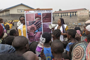 ΠΟΥ: Ανησυχία για τη νέα παραλλαγή της ευλογιάς των πηθίκων
