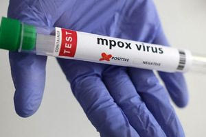 Ευλογιά των πιθήκων: Σε λειτουργία το εμβολιαστικό κέντρο στο Ηράκλειο