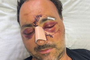 Ξυλοδαρμός Ελληνοκαναδού: Τσακωθήκαμε αλλά δε θέλαμε να τον σκοτώσουμε υποστηρίζουν οι δύο που παραδόθηκαν