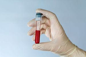 Νέα αιματολογική εξέταση σε παιδιά προβλέπει κίνδυνο για ασθένειες στο μέλλον