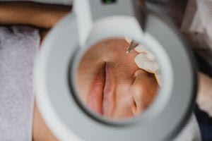 Επεμβάσεις που γίνονται στο πρόσωπο και βελτιώνουν την υγεία