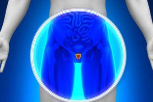 Καρκίνος του Προστάτη: Η πιο συχνή κακοήθης νόσος που απειλεί τους άνδρες