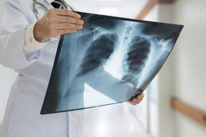 Αυξάνεται ο καρκίνος στην Κρήτη, αλλά σταμάτησε η καταγραφή του