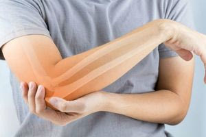 Παγκόσμια Ημέρα κατά της Αρθρίτιδας: Ποσοστό 26% του πληθυσμού στην Ελλάδα πάσχει από κάποια ρευματική – μυοσκελετική πάθηση