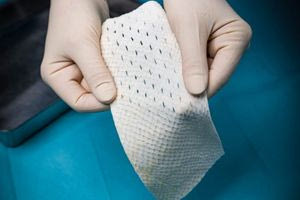 Δέρμα ψαριού επουλώνει τις βαθιές πληγές που προκαλεί ο διαβήτης