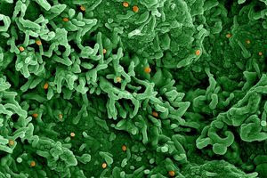 Αυξάνονται τα κρούσματα mpox στην Ευρώπη – Σε ετοιμότητα για διαγνωστικά τεστ