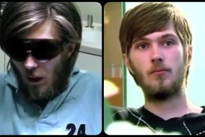 Είχε να πλύνει τα δόντια του 20 χρόνια και ο οδοντίατρος έπαθε «πλάκα» όταν άνοιξε το στόμα του (vid)