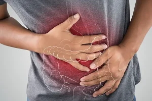 Καρκίνος του παχέος εντέρου: Σε ποιους εμφανίζεται συχνότερα