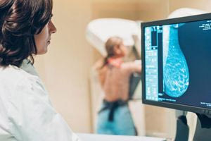 Mαστογραφία: Βοηθάει και στον εντοπισμό καρδιαγγειακών προβλημάτων