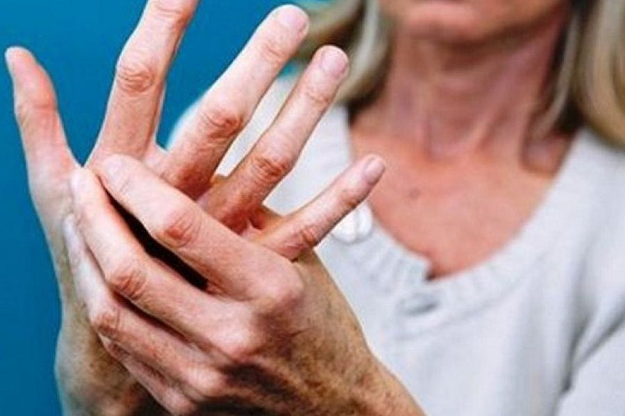 Σκλήρυνση κατά πλάκας: Φάρμακο που “γεννάει” ελπίδες από ομογενή επιστήμονα της Αυστραλίας