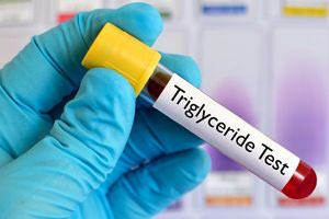 Tριγλυκερίδια: Τα υψηλά επίπεδα τους στο αίμα αυξάνουν τον κίνδυνο για καρδιακές παθήσεις