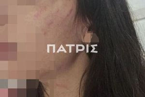 «Μου είπαν να ευχαριστώ τον Θεό που είναι ζωντανή» λέει η μητέρα της 29χρονης Ηρακλειώτισσας που ξυλοκοπήθηκε