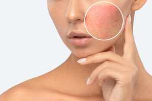 Συμβουλές για να «σβήσουμε» τα σημάδια του χρόνου στο πρόσωπό μας