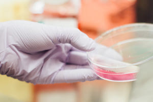 Σημαντική αύξηση του καρκίνου του παγκρέατος την τελευταία πενταετία