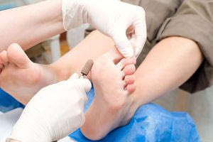 Γιατί οι άνθρωποι αποκτούν κάλους