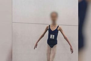 Αυστραλία: Στη φυλακή γονείς μπαλαρίνας που στα 17 της ζύγιζε μόλις 27 κιλά