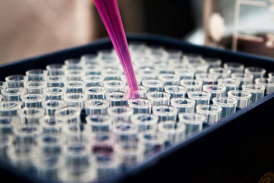 Πώς 5 σταγόνες αίματος μπορούν να δείξουν τη βιολογική ηλικία μας