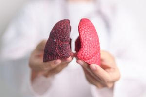 Θεσσαλονίκη: Ξεκινά η χορήγηση εμβολίου για τον καρκίνο του πνεύμονα στο πλαίσιο κλινικής μελέτης