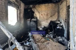 Σε κρίσιμη κατάσταση ο 3χρονος μετά τη φωτιά στο σπίτι του στην Κεφαλονιά – «Δεν γνωρίζουμε ακόμη πώς θα εξελιχθεί»