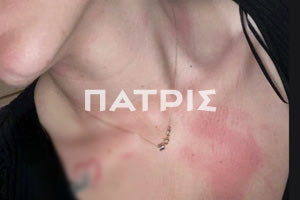 Ηράκλειο: Τέσσερις καταγγελίες και δύο panic button χρειάστηκαν για να εμφανιστεί η ΕΛΑΣ μετά από μισή ώρα