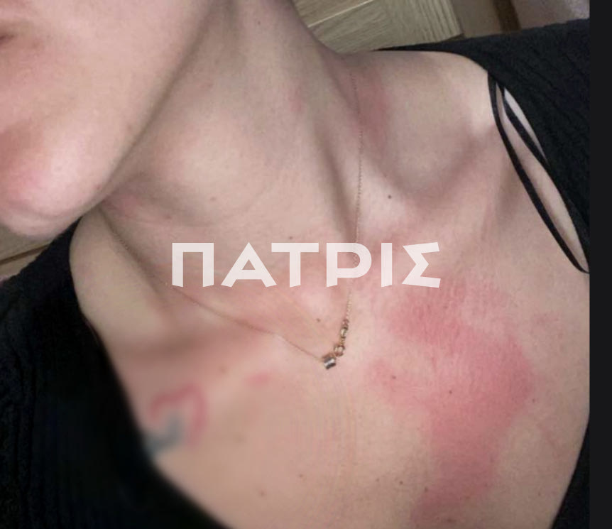 Ηράκλειο: Τέσσερις καταγγελίες και δύο panic button χρειάστηκαν για να εμφανιστεί η ΕΛΑΣ μετά από μισή ώρα