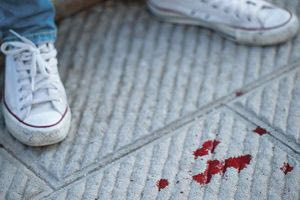 Πάτρα: Ελεύθεροι οι πέντε μαθητές που κατηγορούνται για τον τραυματισμό 13χρονου