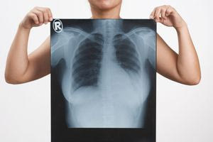 Οι μεγαλύτερες εφευρέσεις που έγιναν… κατά λάθος!