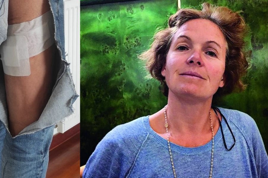 Βουλιαγμένη: «Εξαφανίστηκε και δεν μου ζήτησε ούτε συγγνώμη» είπε ο άνδρας που τον δάγκωσε το σκυλί της μητέρας Τσιτσιπά