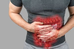 Καρκίνος Παχέος Εντέρου: Tο ενοχλητικό σύμπτωμα που προειδοποιεί έγκαιρα