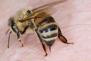 Μεσαρά: Επτάχρονο αγόρι στο νοσοκομείο από τσίμπημα μέλισσας