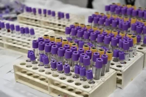 Τι παθαίνει ο ανθρώπινος οργανισμός όταν γίνεται λανθασμένη μετάγγιση αίματος όπως συνέβη στο Τζάνειο με την 62χρονη