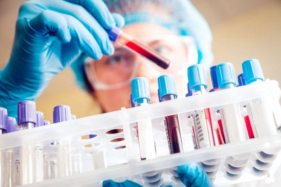 Καρκίνος: Εξέταση αίματος τον εντοπίζει τρία χρόνια πριν από τη διάγνωση