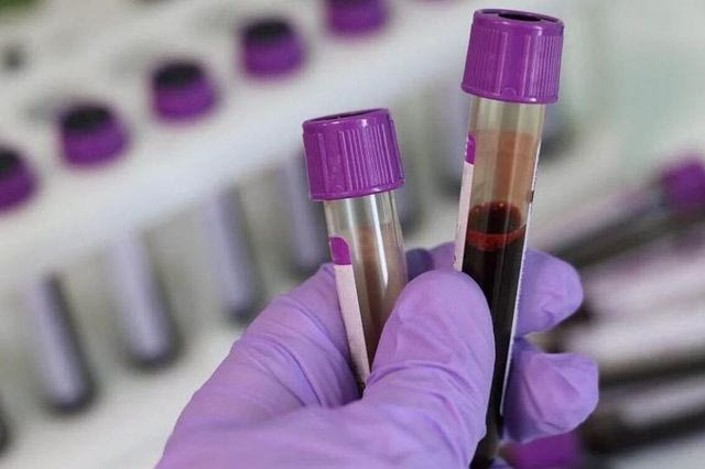 Μπορεί μία εξέταση αίματος να διαγνώσει έγκαιρα διάφορες μορφές καρκίνου;