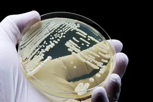 Μύκητες: Η Τεχνητή Νοημοσύνη μπορεί να τους αναγνωρίσει με ένα… κλικ