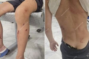 Βόλος: Στο νοσοκομείο 7χρονο αγόρι έπειτα από επίθεση αδέσποτων σκύλων