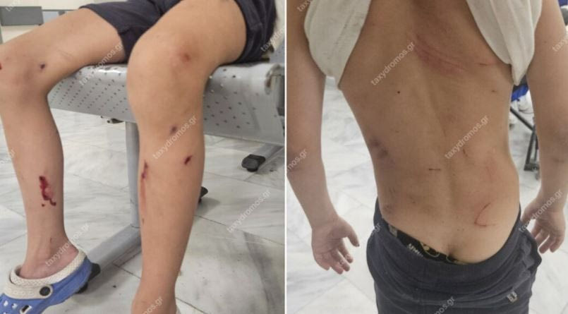 Βόλος: Στο νοσοκομείο 7χρονο αγόρι έπειτα από επίθεση αδέσποτων σκύλων
