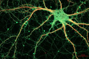 Παράγουν οι ενήλικες νέους εγκεφαλικούς νευρώνες;