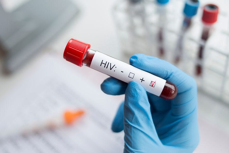 ΕΟΔΥ: Μικρή μείωση των νέων διαγνώσεων AIDS το 2024
