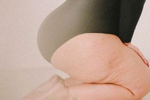 Κυτταρίτιδα: Δεν είναι ντροπή, δεν είναι ασθένεια – Φορέστε το μαγιό σας