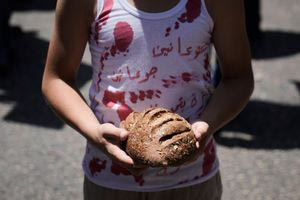 Εκατοντάδες παιδιά από τη Γάζα θα μεταφερθούν στο Ηνωμένο Βασίλειο για ιατρική φροντίδα