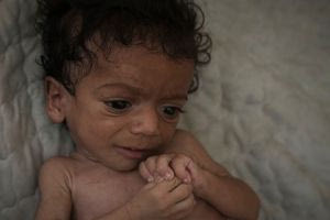 ΟΗΕ: Λιμός επιβεβαιώθηκε για πρώτη φορά στην πόλη της Γάζας